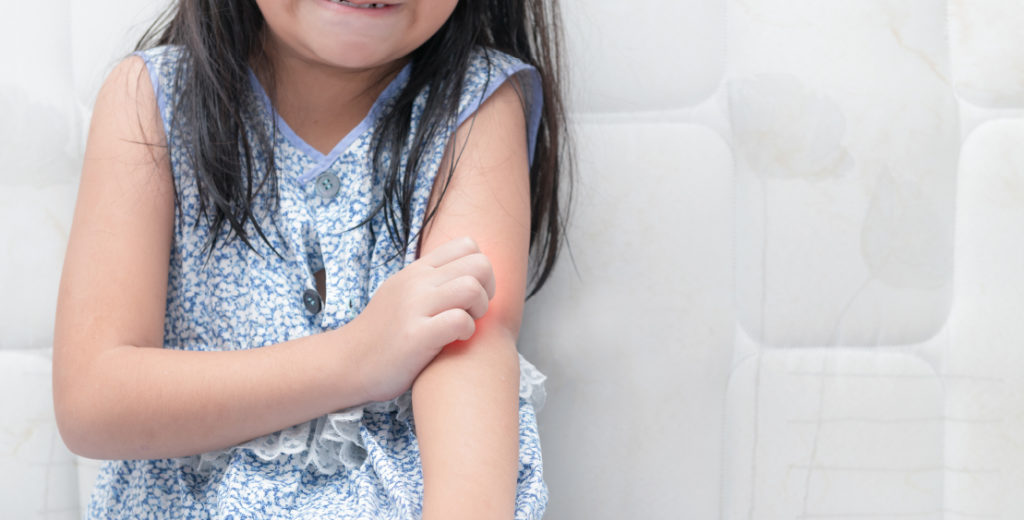 Lutter contre l’eczéma des enfants